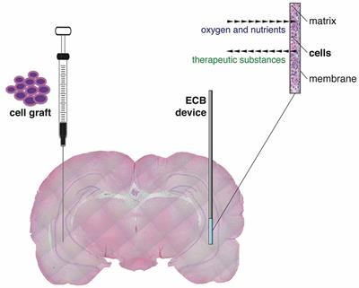 New Tools for Epilepsy Therapy